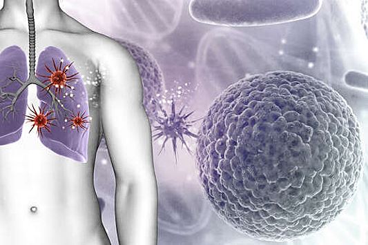 Бактериальные токсины предложили использовать в лечении рака легких