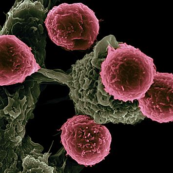 Ученые разработали комбинированную иммунотерапию для борьбы с раком поджелудочной железы