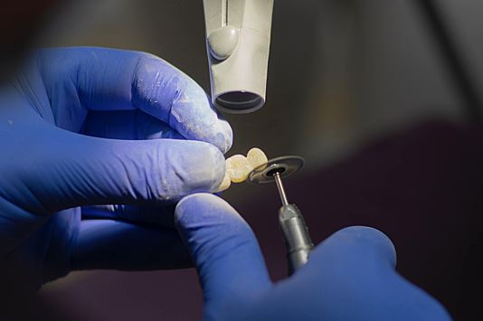 Раскрыты способы преодоления страха перед походом к стоматологу